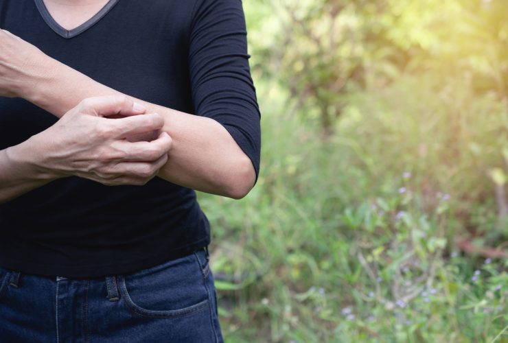 Itchy Skin Header Image